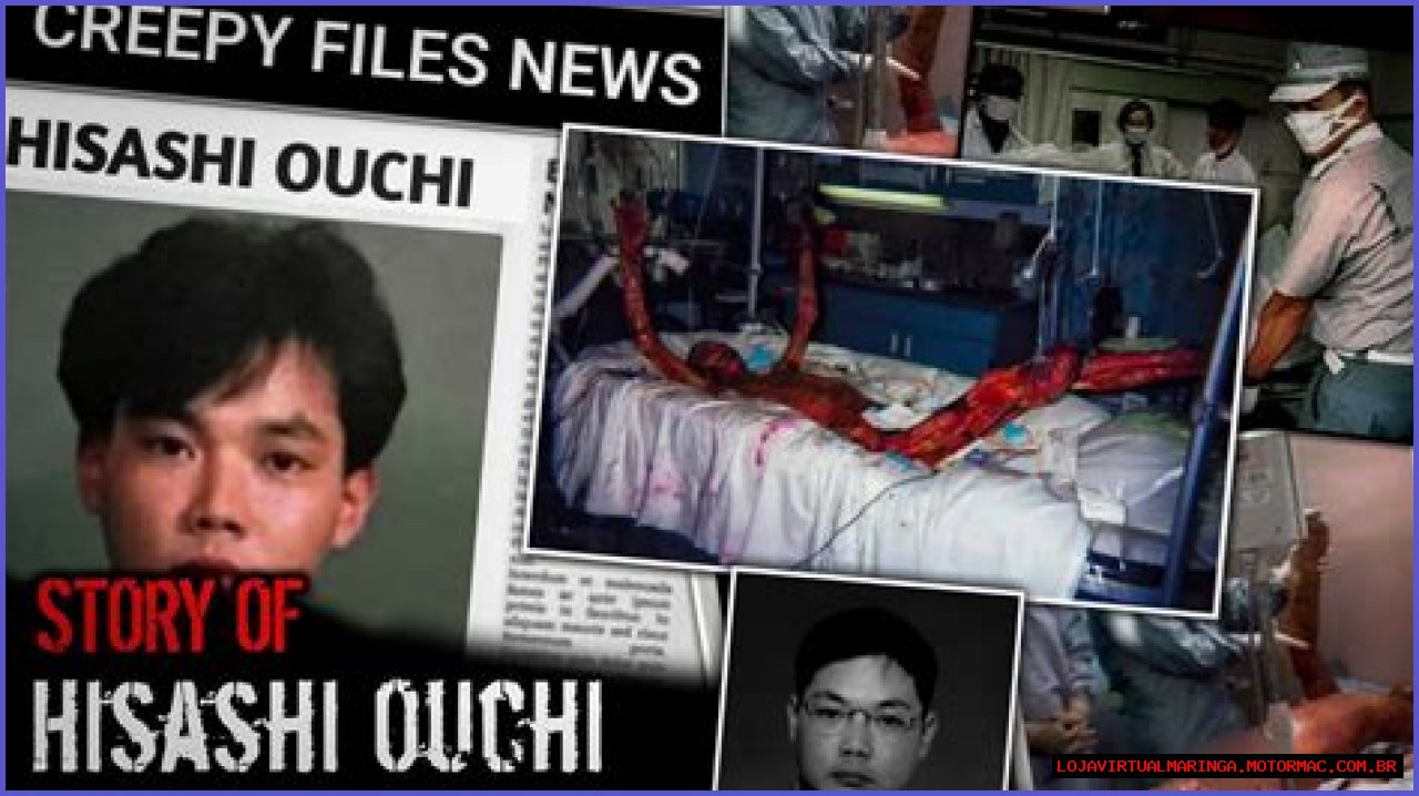 Hisashi Ouchi: The Tragic Story Behind The Real Picture
